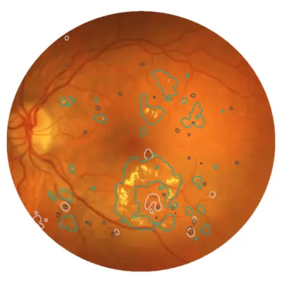 Eye scan